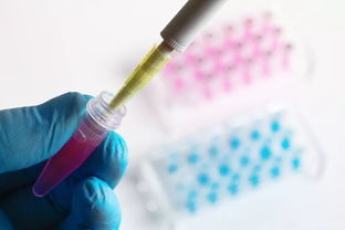 痛心！《柳葉刀》 一年新增30萬年輕癌癥病人，4種癌奪走他們的生命